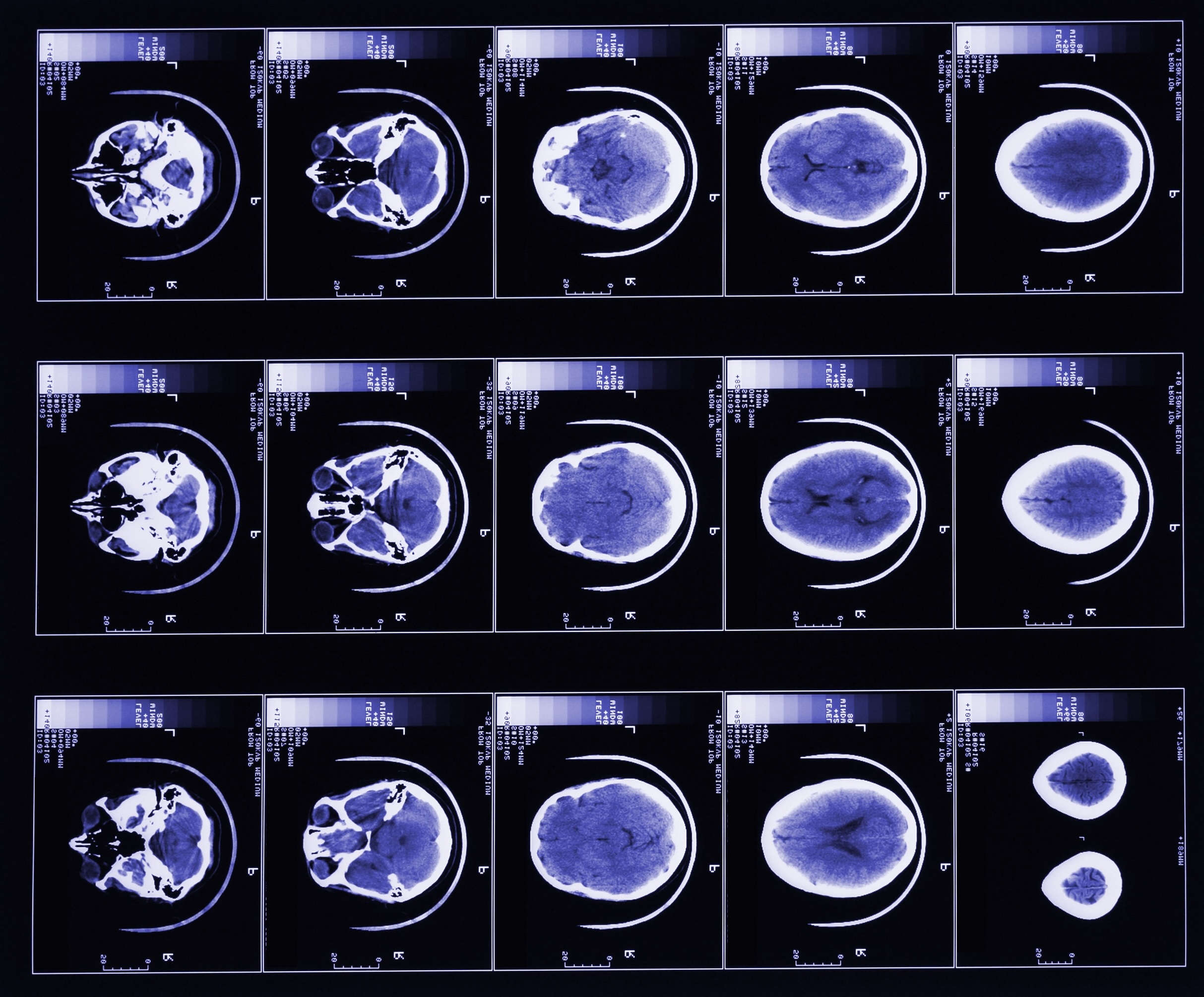 CT-Aufnahmen eines Schädels als Beispiel für digitale Bildgebung in der elektronischen Patientenakte und rechtssichere Archivierung