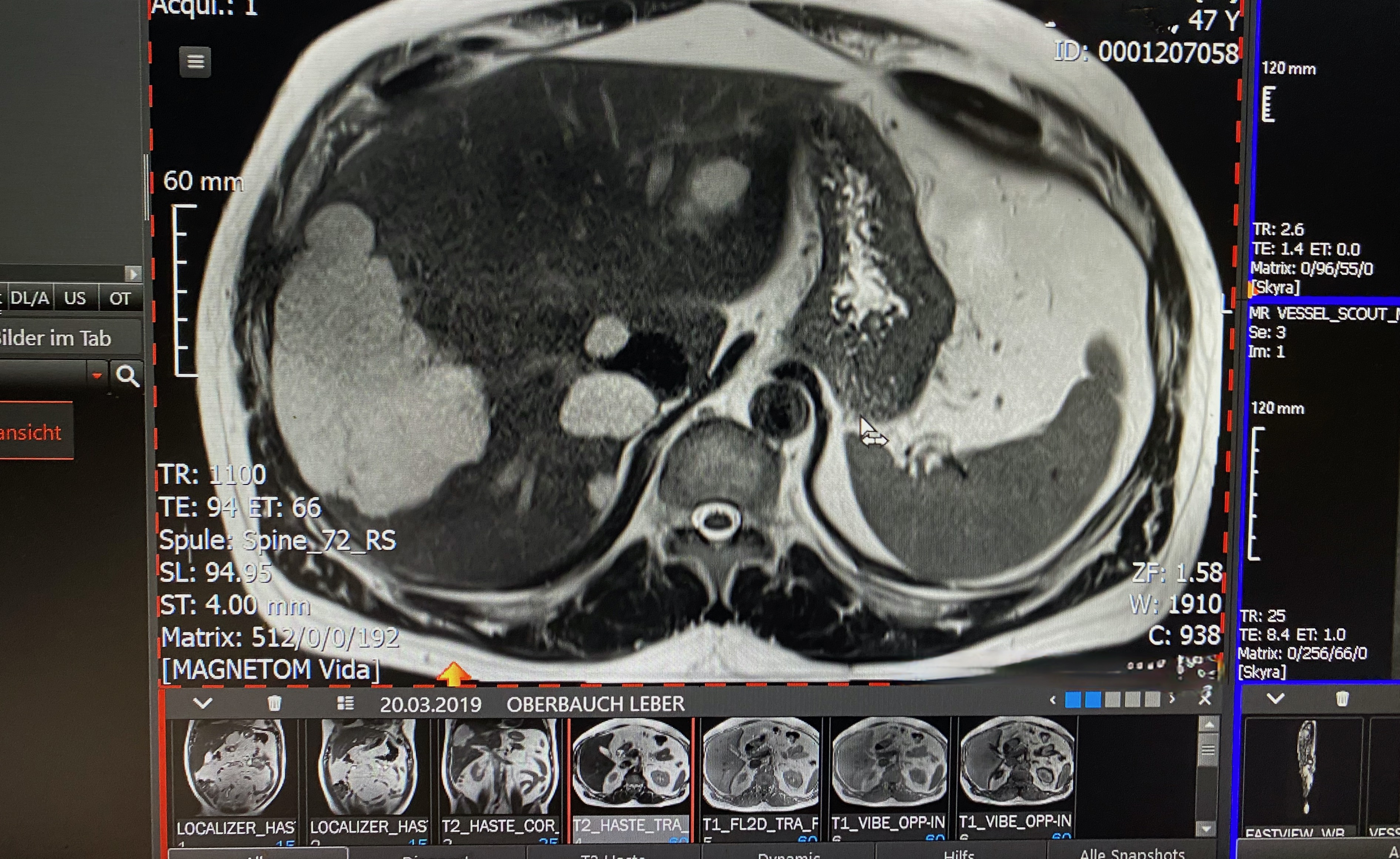 facharzt-fuer-radiologie-oder-nuklearmedizin-m-w-d-als-regelmaessige-praxisvertretung-gesucht.jpeg